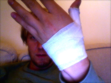 sore hand